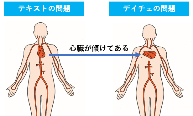 サピックスのテストで出題された問題のイメージを説明する人体図のイラスト。テキストと比較して、テストでは心臓の位置が傾けられている。